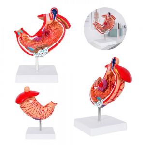 MODELO GASTRO personalizada